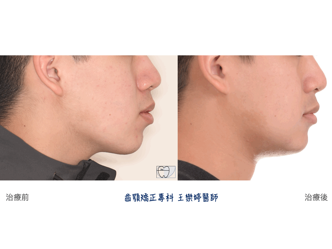 DRN 1