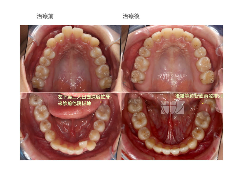 網站內容編輯.002 3