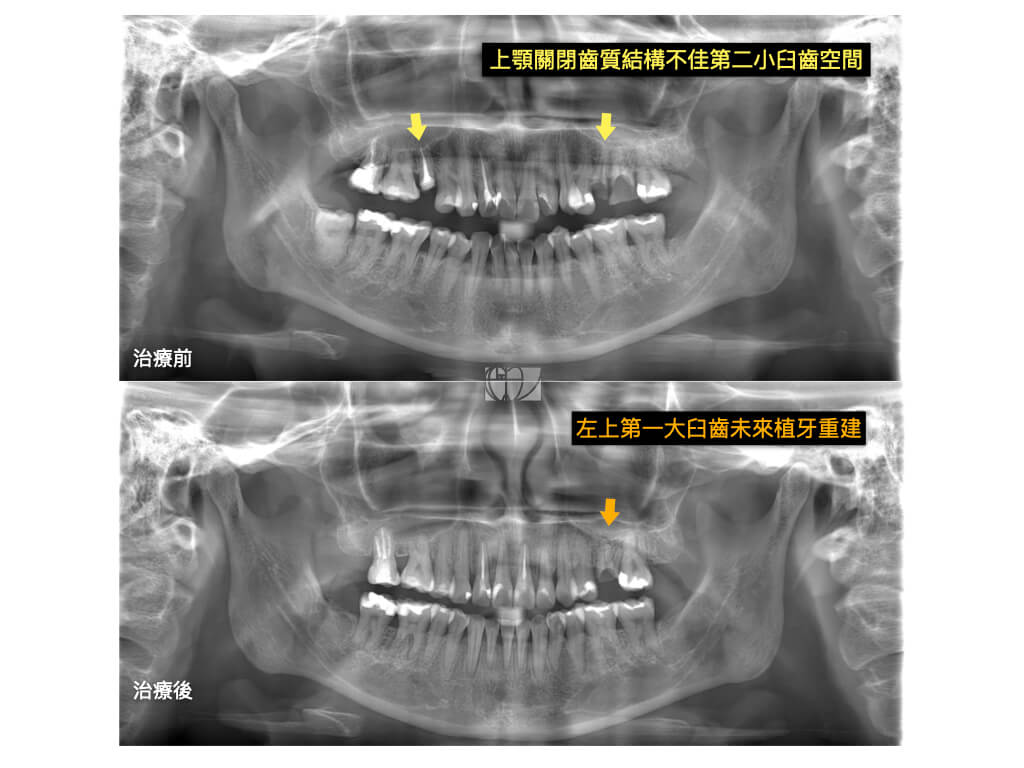 王樂婷醫師.004 2