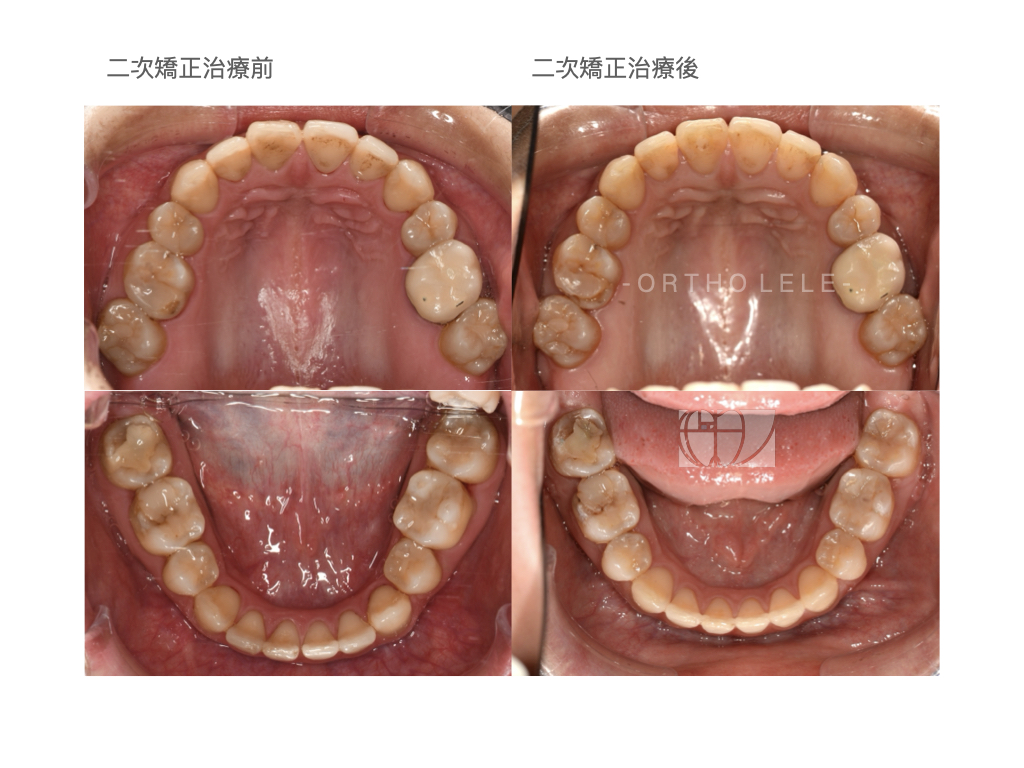 王樂婷醫師治療案例.003