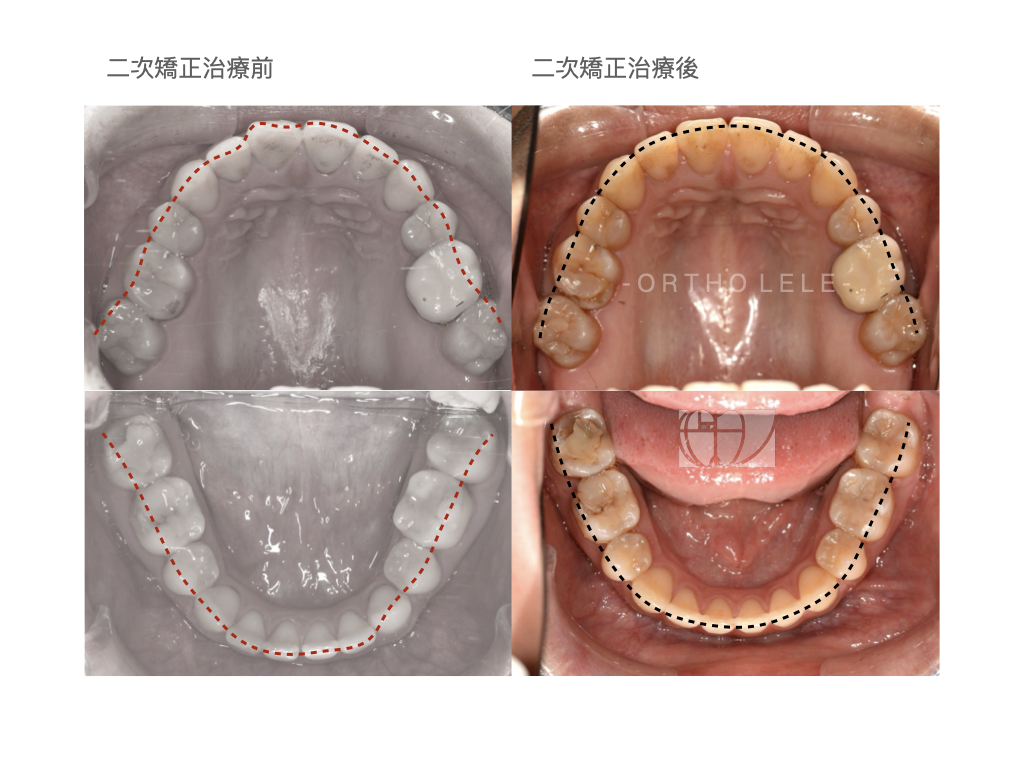 王樂婷醫師治療案例.005