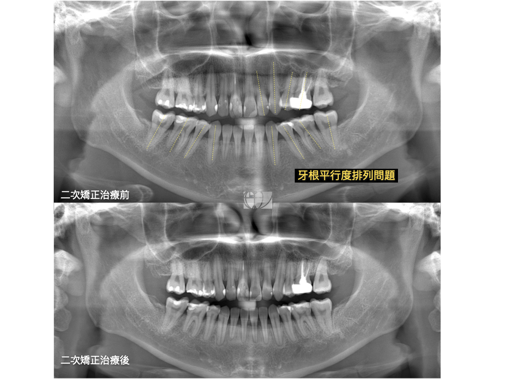 王樂婷醫師治療案例.007
