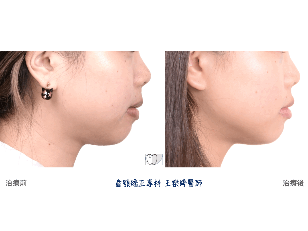 王樂婷醫師治療案例